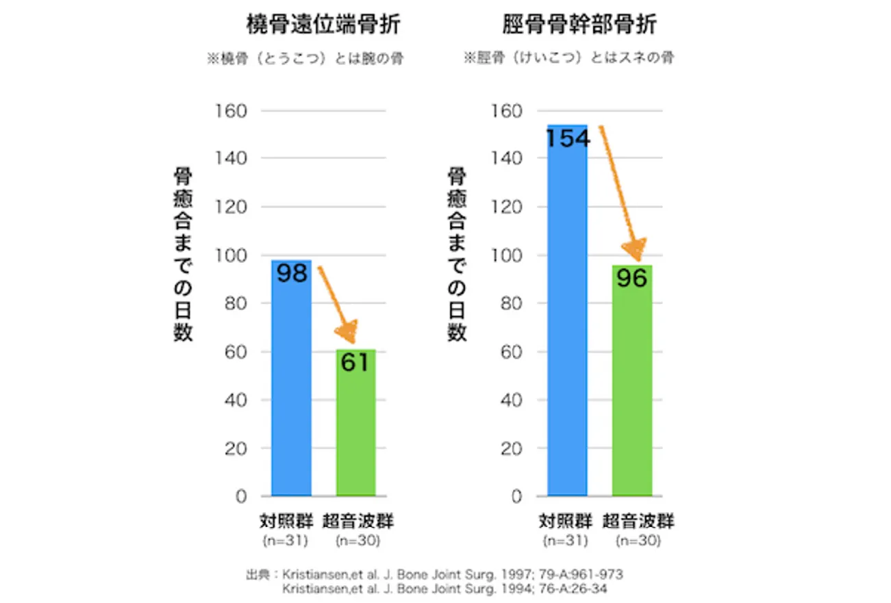 骨癒合までの日数 橈骨遠位端骨折 脛骨骨幹部骨折