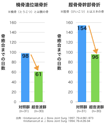 超音波骨折治療の研究結果